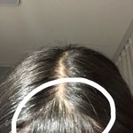 어떡하냐 앞머리 <b>족</b>댐