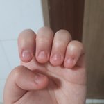 <b>손톱</b> 물어뜯기 고친 사람ㅠ?