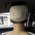 도와주세요. 뼈가 보일만큼 폭행당해 <b>입원</b>중이나 피의자신분이 되었습니다