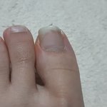 내 <b>내성</b> 발톱 괜찮을까..?(발혐주의)