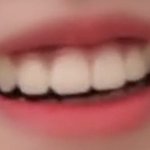 [댓글부탁해] 나 <b>치아</b> 조카 가지런함