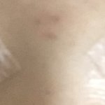 [댓글부탁해] 나 어제 <b>쌍수</b>했는데 <b>라인</b>어때?