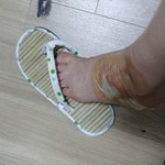 [방탈죄송]<b>SS</b> Shiny 무선드라이기 폭발사고 화상(구매하지마세요)