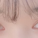 <b>쌍수</b> <b>티</b> 많이나?