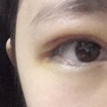 사진있)붓기빨리 빠지면 <b>속</b><b>쌍</b>돼..??