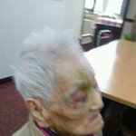 강서구 요양원 폭행사건!!!!!!!!!!!