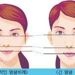 성형해도 ㄹㅇ답이 없는 얼굴은 이거지ㅇㅇ
