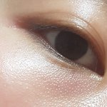 <b>눈밑</b>에이거뭐야?