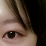 [꼭조언부탁] 쌍수 추천