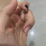 나 손가락 부었는데 어떡해... ㅠㅠㅠㅠㅠㅠㅠㅠ