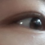 나 쌍수 날짜 잡았어