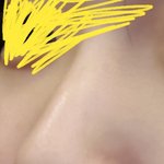 코 <b>평타</b>침?