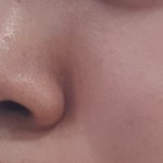 극혐주의    이런피부......