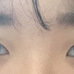 <b>재업</b>) 이런 눈 쌍수 가망 있어??ㅠㅠ