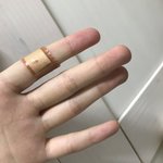 [댓글부탁해] 하; 스테이플러 때메 <b>살점</b> 파임