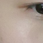 이거 병원에 따져야하나