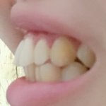 [드루와] 나 약간 <b>프레디</b>머큐리 처럼 이빨툭튀임ㅠㅠㅠ