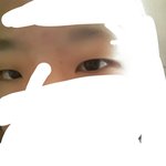 이런눈은 어떤식으로 쌍수해야되냐