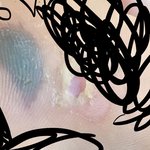 야 발에 <b>물집</b> 이거 가위로 뜯을까 말까