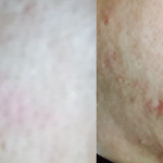 [피부] 피부 안좋은 사람 읽어보세요! (2018 <b>ver</b>.) *펌*