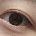 쌍수고민