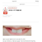 [댓글부탁해] <b>앞니</b> 크기 대결