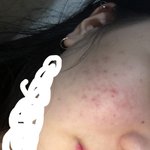 [댓글부탁해] 헥 나 피부차이봐;