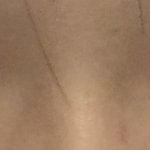 [조언부탁해] + 나 뒷트임 시급하지