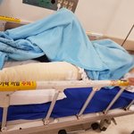 (추가)차에 28차례 치였습니다.