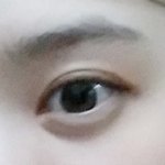 [댓글부탁해] <b>쌍수</b>했는데 어땡??