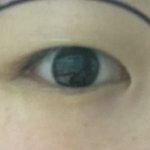 [댓글부탁해] 쌍수한 사람 있으면 한번만 봐주라