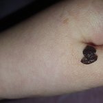 [댓글부탁해] 아 이거 <b>편도</b>결석? 그거 맞음...?