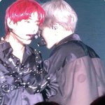 [방탄소년단] 이거 부황 <b>자국</b> 맞지????