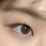 쌍수 <b>상담</b>하러가는데