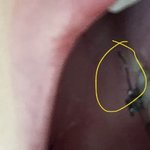 교정하는애들 ㅈㅂ 들어와주라 급해 사진 있어
