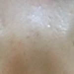 [조언부탁해] 이번겨울에 <b>쌍수</b>할껀데 <b>라인</b>추천좀해줘!