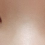 얘들아 나 성형 어떻게 해야 할까?ㅠㅠ