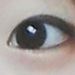 나 쌍수 사진 털게