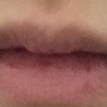 야들아 <b>나입</b>슐 왜 짝짝이인줄 알아??