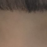 [조언부탁해] 나 쌍수 <b>재수술</b> 해야겠지ㅜㅜㅜ...?