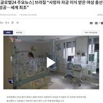장기<b>이식</b> 기술 근황 ㄷㄷㄷ