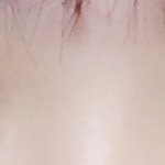 앞트임 해야할까!!!!!!!!!!!!!!!!!!!?!!!!!!!...