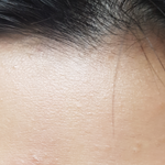 [댓글부탁해] 제발ㄹ <b>이마</b>에 이거 왜 이런지 아는사람