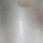 이런 눈 쌍수하면 어케 됨?