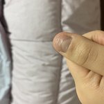 <b>손톱</b> ㅇ거 물어뜯는거땜에ㅜ그런거임?
