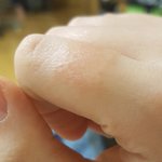 [댓글부탁해] 내 손가락 왜이러냐 ㅠㅠㅠㅠㅠㅠㅠㅠㅠ??????