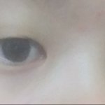 애드라 나 <b>눈매</b>교정할건데 봐주람