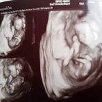 [댓글부탁해] 15주4일 초음파 <b>성별</b> 뭘까요?