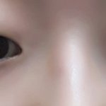 [댓글부탁해] 쌍수할까 말까????