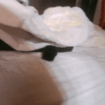 쌍수 <b>수술시간</b> 얼마걸려??